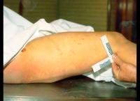 Medical Detectives - Geheimnisse der Gerichtsmedizin