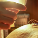 Spitzenmedizin: Akupunktur - Mythos oder Therapie?