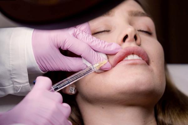 Bild 1 von 1: Aufgrund eines Unfalls muss sich Estelle regelmäßig die Lippen aufspritzen lassen.