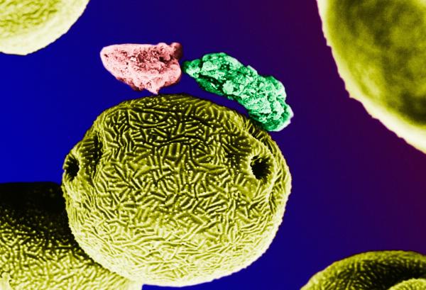 Bild 1 von 10: Wir verbringen rund 90 Prozent unseres Lebens in geschlossenen Räumen und atmen dort die Luft ein, die uns umgibt und in der wir leben. Diese Sendung untersucht, wie Luft uns gesund oder krank machen kann, denn jeder einzelne Atemzug bringt die Stoffe aus der Raumluft nicht nur in die Lunge, sondern hat potenziell Auswirkungen auf den ganzen Körper und sogar die Psyche. Im Bild: Winzige Partikel aus der Innenraumluft - gefangen in einem Filter. Elektronenrastermikroskopaufnahme, bearbeitet von Lennart Nillson.