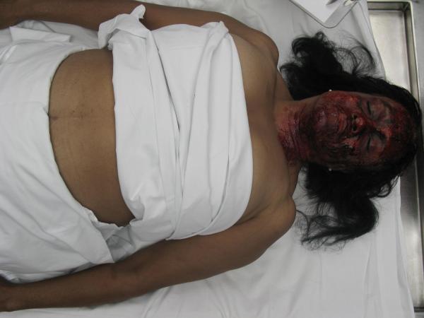 Bild 1 von 71: (4. Staffel) - Dr. Jan Garavaglia, eine der renommiertesten Pathologinnen in den USA, gibt einen Einblick in ihre Arbeit und erklärt, wie sie zusammen mit ihrem Team bei der Lösung komplizierter Mordfälle hilft und medizinische Absonderlichkeiten aufklärt.