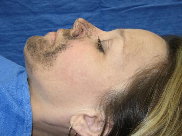 Bild 1 von 113: In der Reality-Doku \