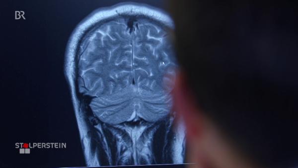Bild 1 von 6: Aufnahme eines Gehirnscans