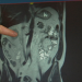 Mit dem Urologen im OP - Unter der Gürtellinie