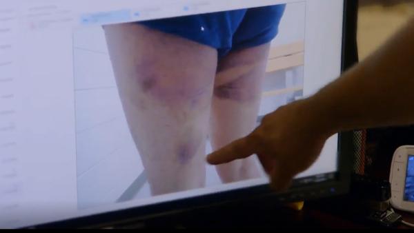 Bild 1 von 3: Auf einem Monitor zeigen Ermittler die schweren Verletzungen eines Mannes, der berichtet, von einem Kartell brutal misshandelt worden zu sein, um ihn zur Zusammenarbeit zu zwingen.