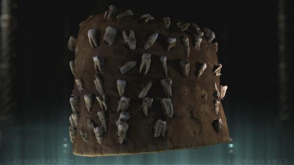 Bild 1 von 2: Dieser Filzhut ist etwa 20 Zentimeter hoch, 17 Zentimeter breit und mit zahlreichen menschlichen Zähnen versehen.