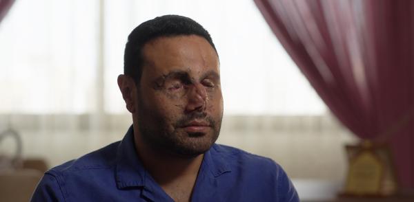 Bild 1 von 6: Ali Ibrahim wird am 17. September von einem explodierenden Pager schwer verletzt.