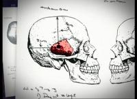Medical Detectives - Geheimnisse der Gerichtsmedizin