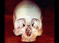 Medical Detectives - Geheimnisse der Gerichtsmedizin