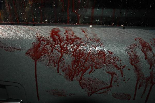 Bild 1 von 50: In der Reality-Doku \