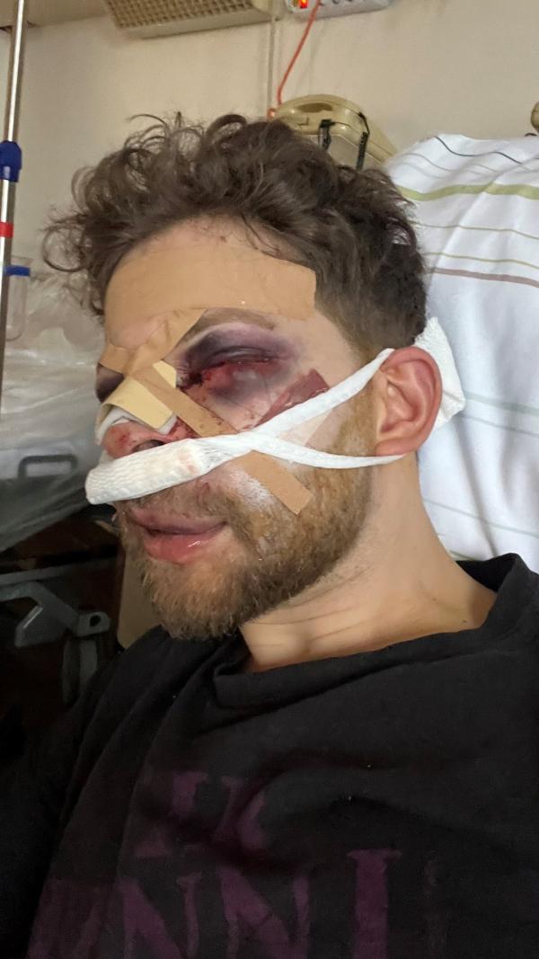 Bild 1 von 13: Lahav Shapira nach dem Angriff 2024