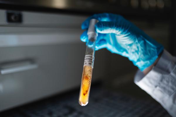 Bild 1 von 7: Einzigartig in Deutschland ist die Stammsammlung von circa 50 000 Mikroorganismen der Jena Microbial Resource Collection (JMRC). Als eine der weltweit größten Sammlungen enthält sie Isolate von rund 15 000 Pilze und 35 000 Bakterien.