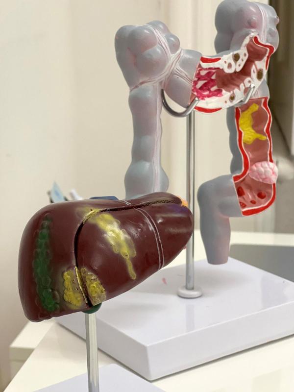 Bild 1 von 8: Im Bild: Modell Leber.