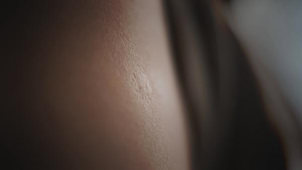 Bild 1 von 1: Um die 50-Jährige tragen oft ein Andenken an die Pockenimpfung ihrer Kindheit.