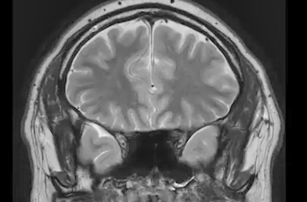 Bild 1 von 1: Die Arbeit hört nicht auf, wenn er nach Hause kommt. Im Schlaf jagt ihn der Fließbandrhythmus.