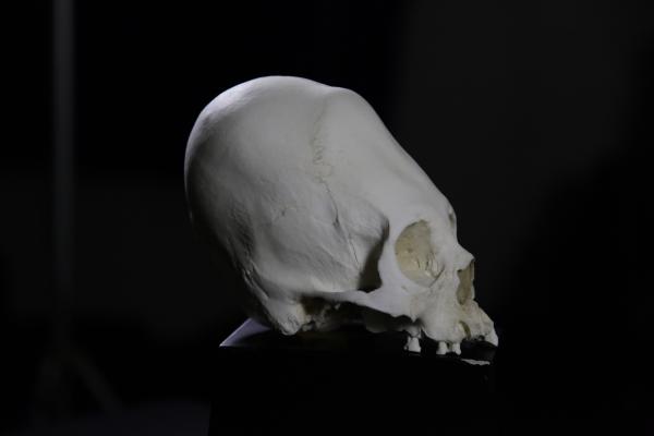 Bild 1 von 3: Die Hunnen waren bekannt für ihre besondere Schädelform, den sogenannten Turmschädel.