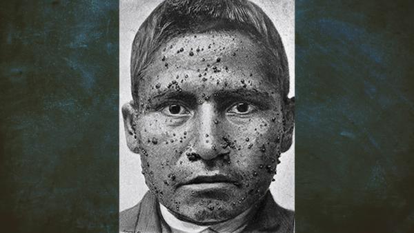 Bild 1 von 6: In Peru greift im 19. Jahrhundert eine mysteriöse Seuche um sich.