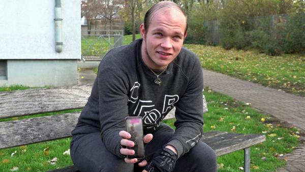 Bild 1 von 1: Dominick leidet extrem unter seinem Haarausfall.