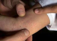 Medizin in fernen Ländern