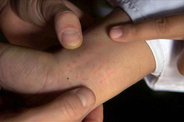 Bild 1 von 5: Was auf Aungs Handgelenk tätowiert ist, ist allein für Meister bestimmt, die die höchste Kraftstufe haben - d. h. die Meister der Pflanzenmedizin und der spirituellen Medizin.