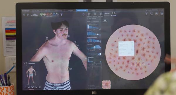 Bild 1 von 1: Bild: Moderne Hautscanner analysieren jeden Millimeter der Haut.
