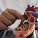 Rettung fürs Herz- Stent, Bypass, Klappenersatz