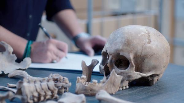 Bild 1 von 13: Knochenfunde liefern den Beweis: Schon im Mittelalter konnten Schädelverletzungen operiert werden.