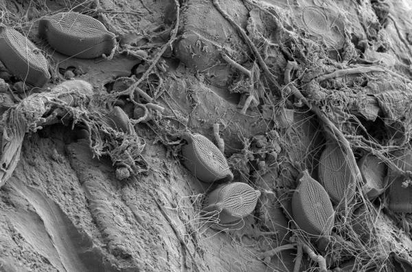 Bild 1 von 5: Plastikfund aus dem Westatlantik: Auf der Oberfläche siedeln Kieselalgen, Mikroben und Bakterien. Ein schleimiger Biofilm schützt die Mikroorganismen, feine Chitin-Fäden geben Halt.